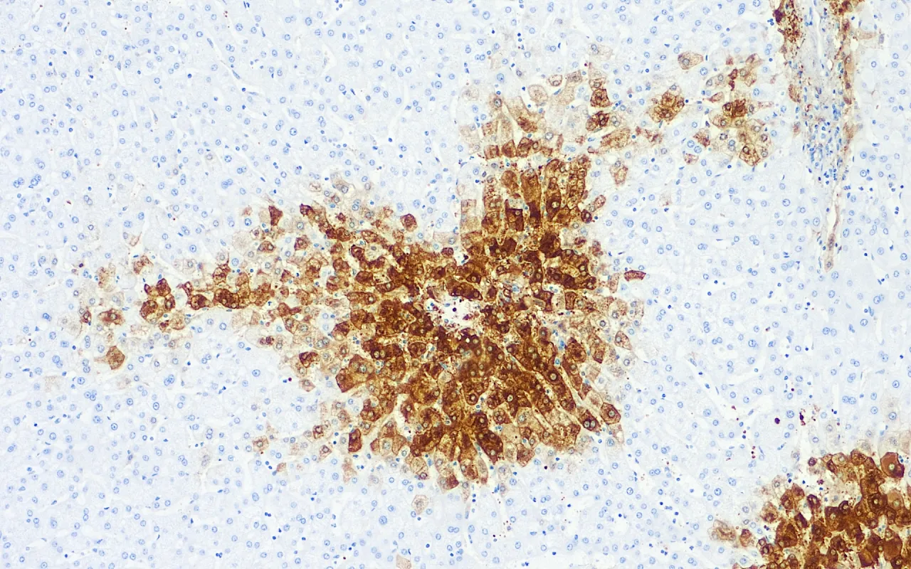 Glutamine Synthetase