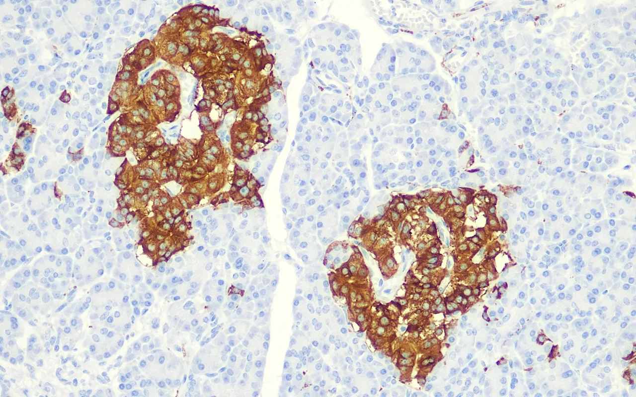 Synaptophysin