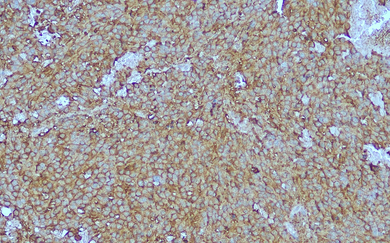 Prolactin