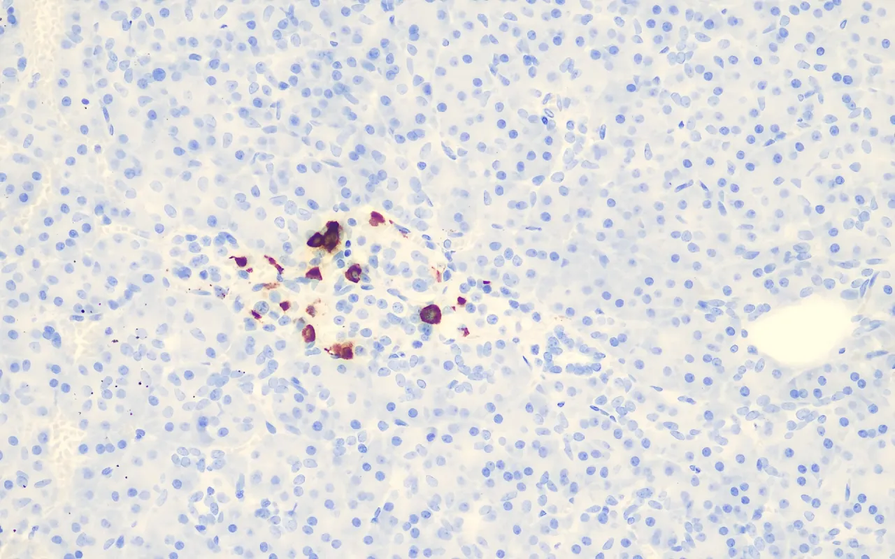 Somatostatin
