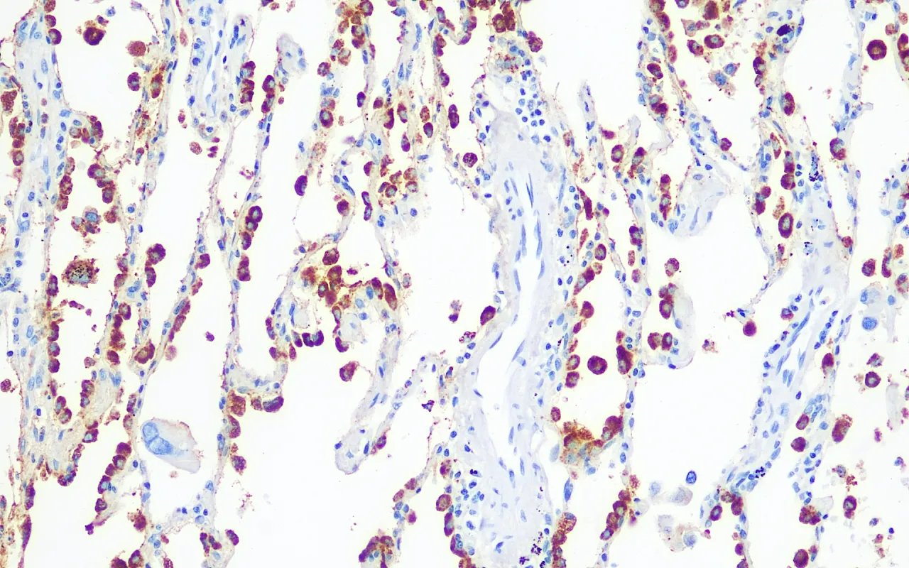 Surfactant Protein B