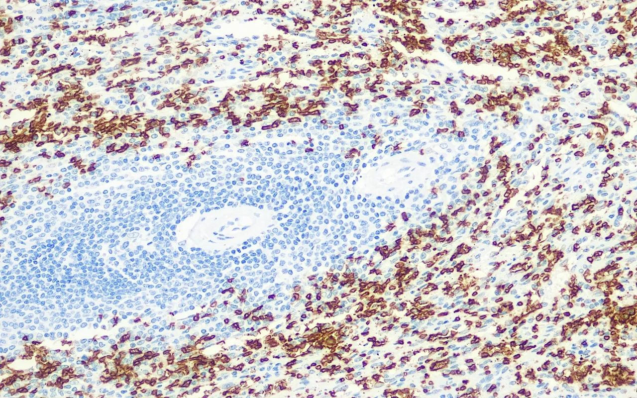 GlycophorinA/CD235a
