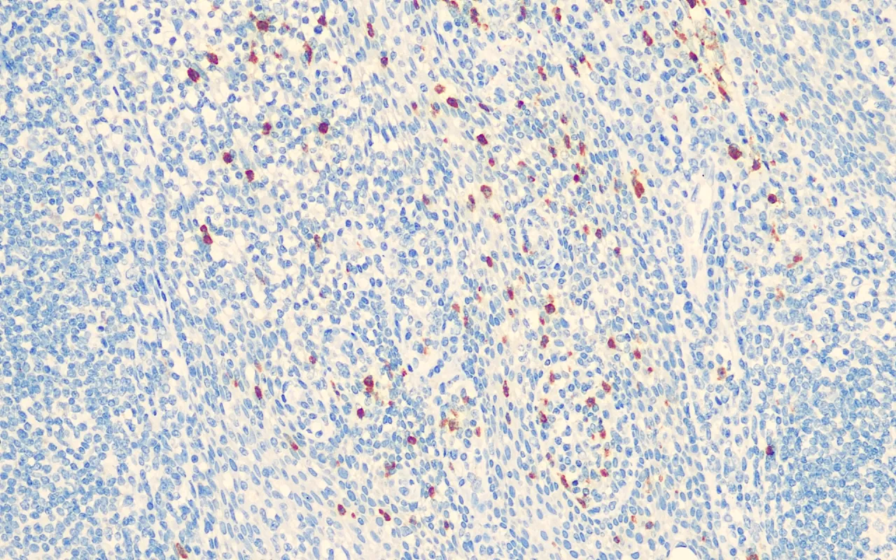 Myeloperoxidase