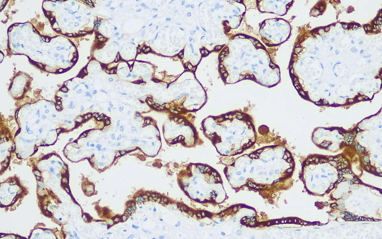 Human Placental Lactogen