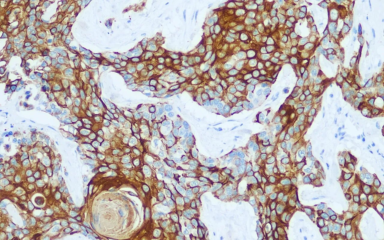Cytokeratin 17