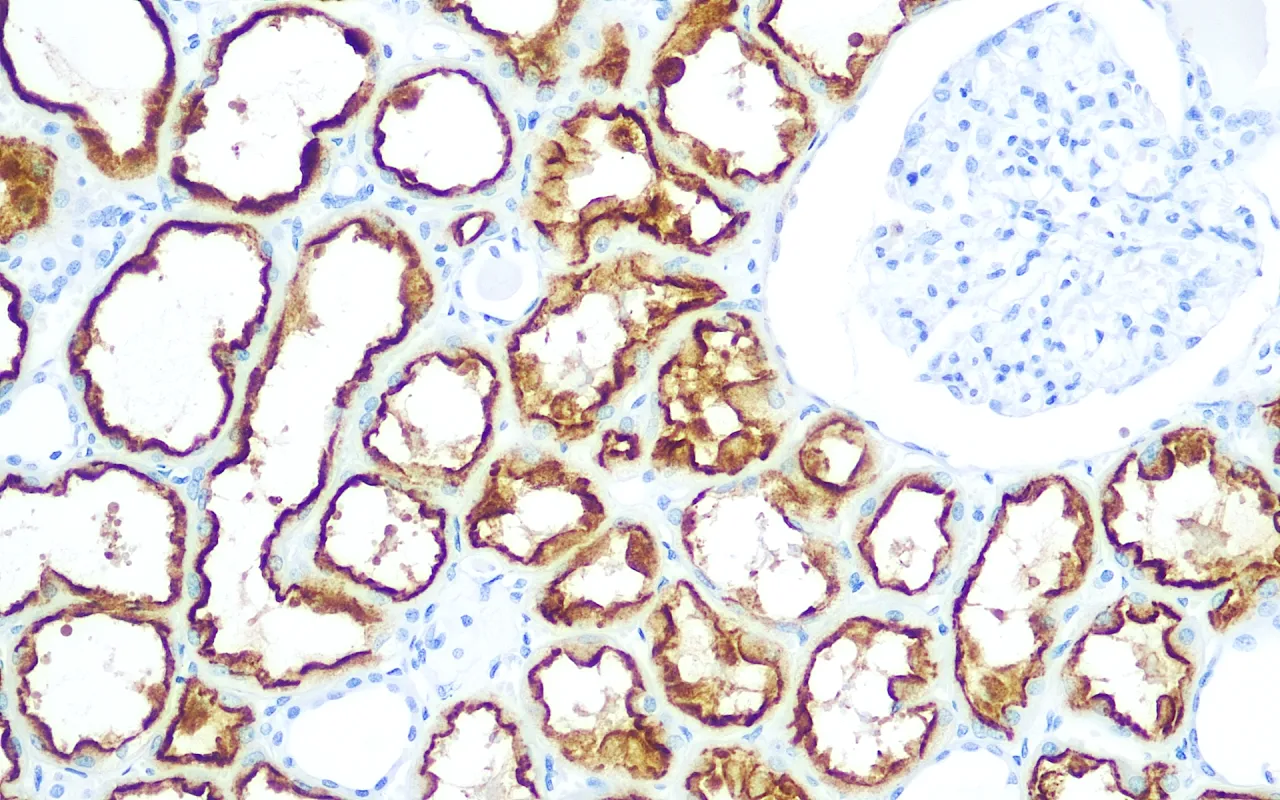 RCC