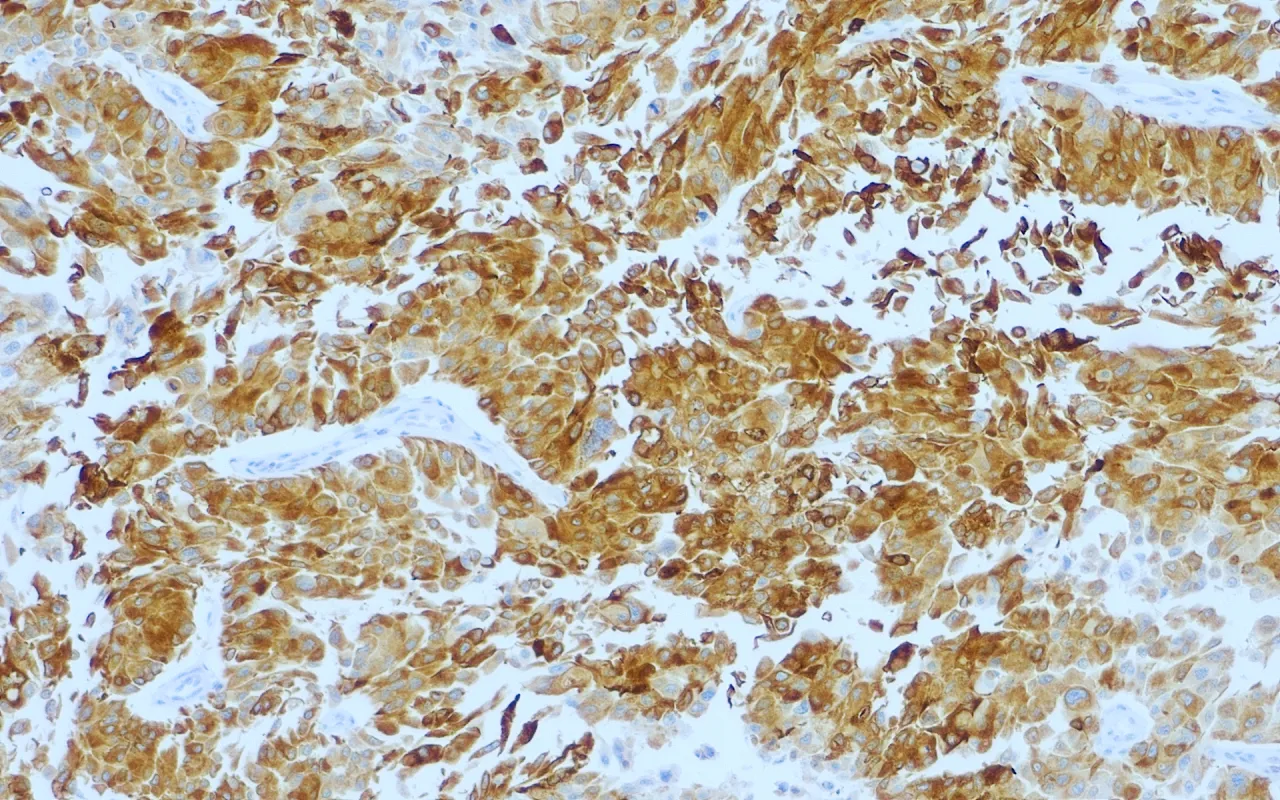 Uroplakin II