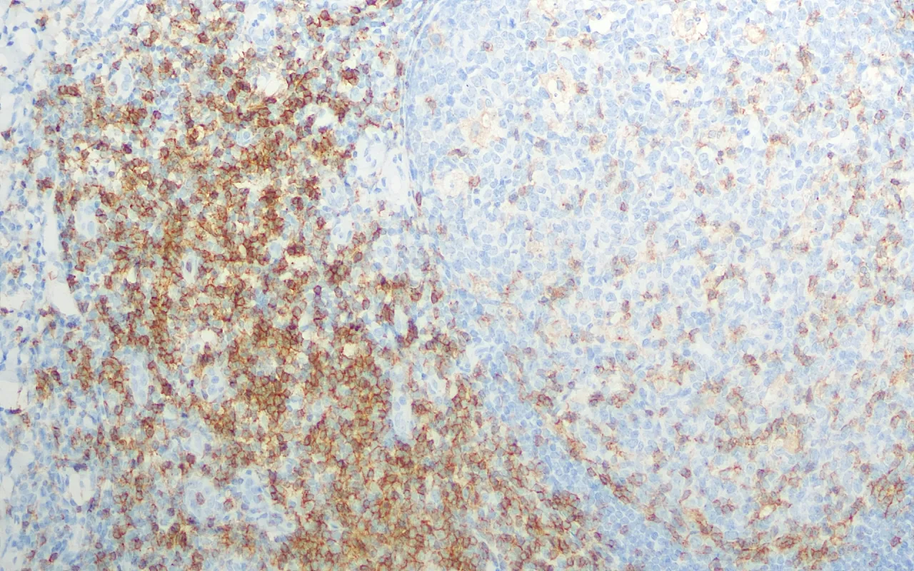 CD4