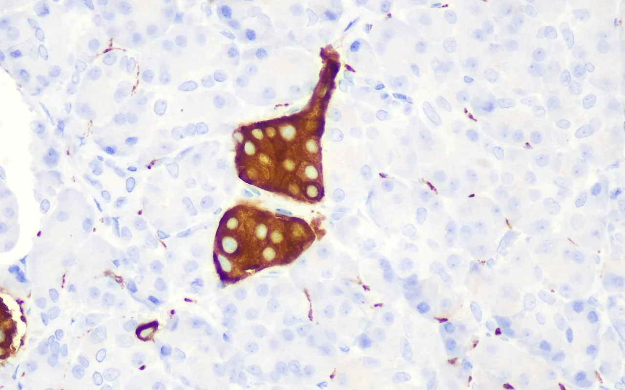 Synaptophysin