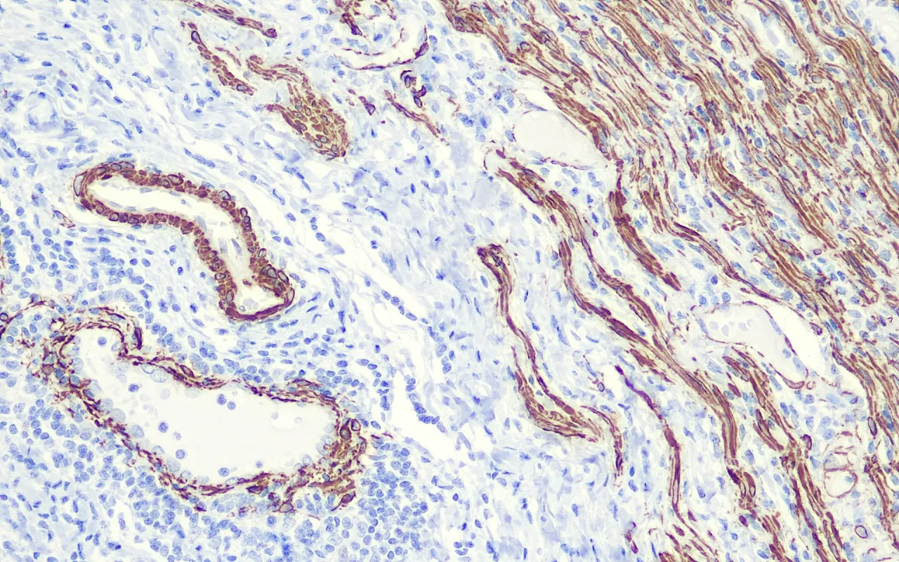 Actin, Smooth Muscle