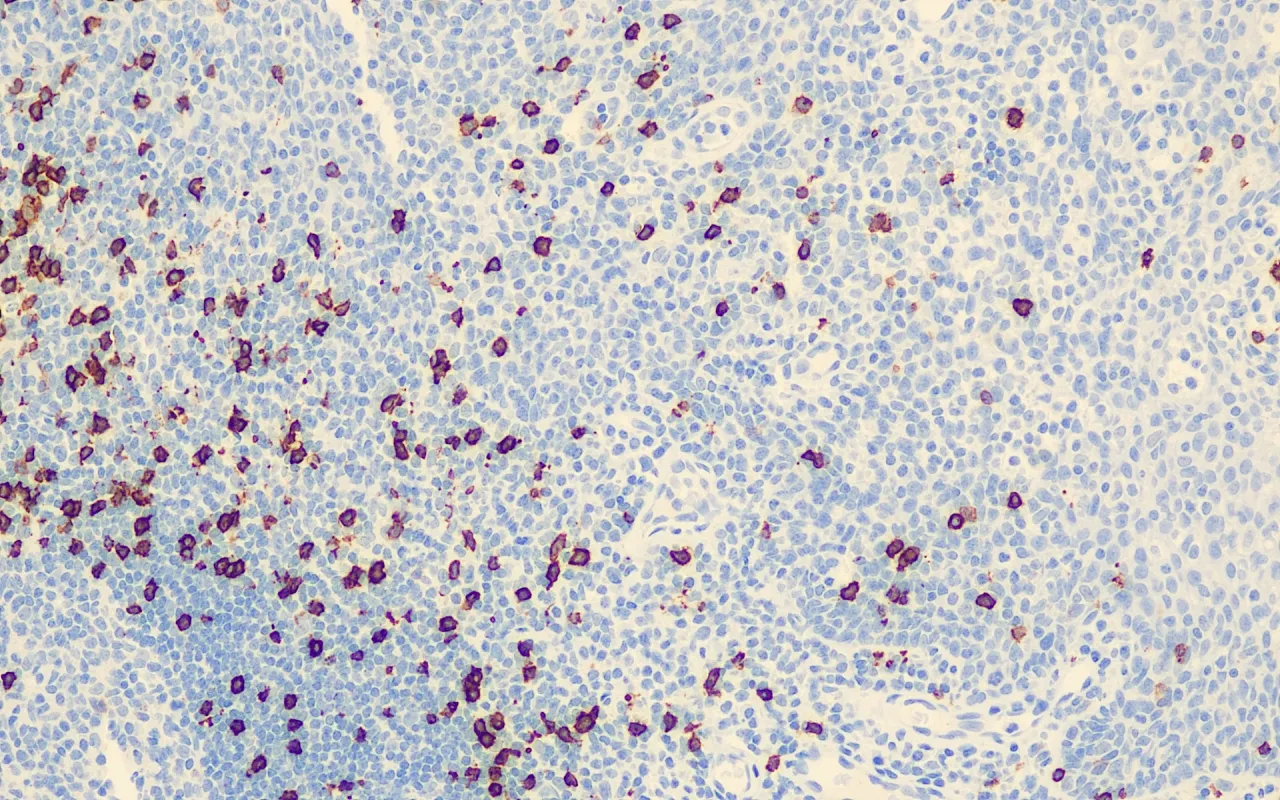 CD8