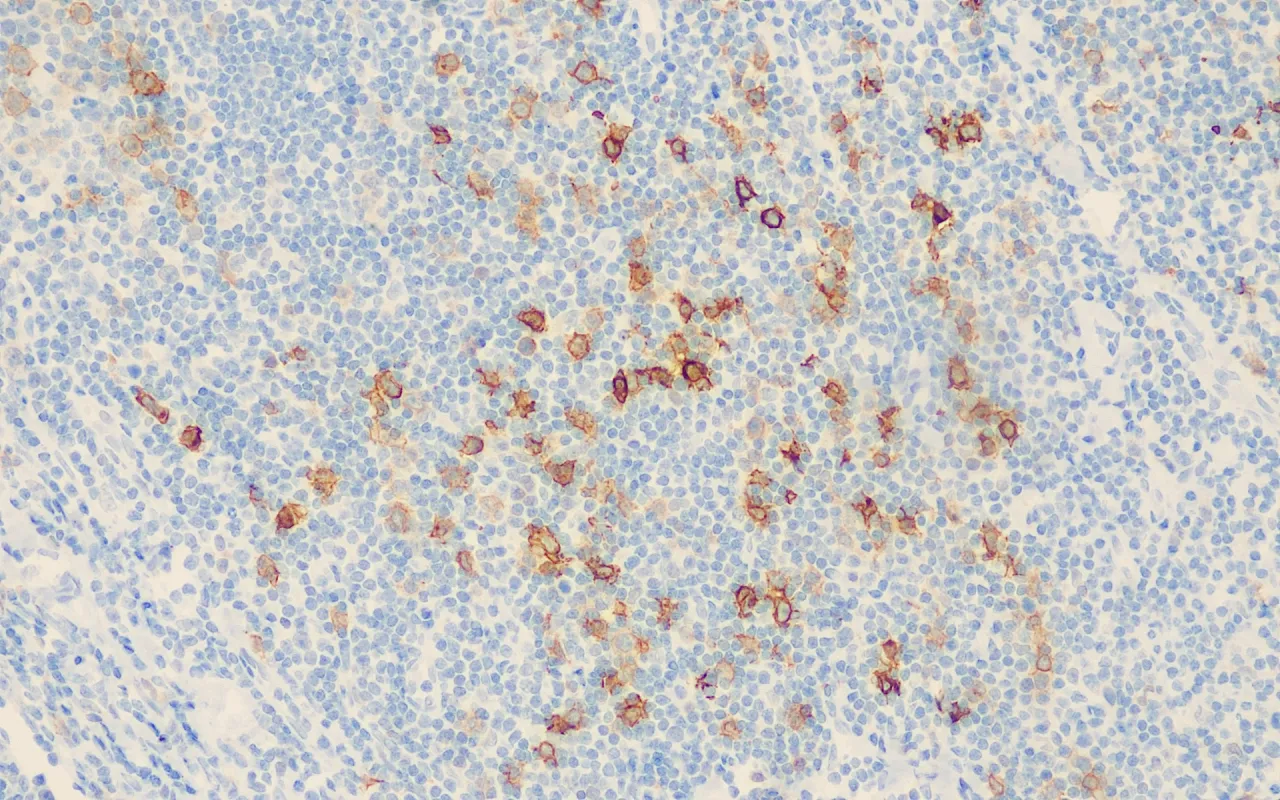 CD30