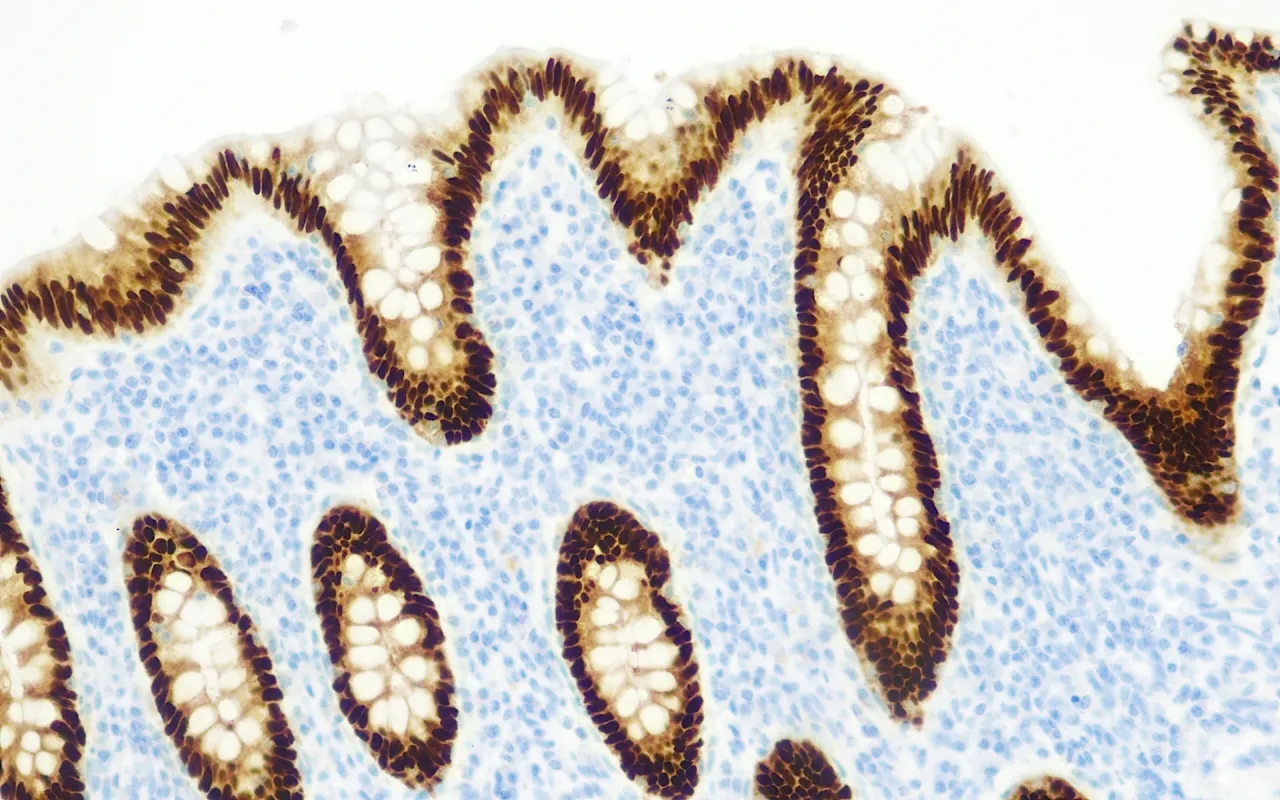 CDX-2